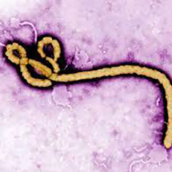 Ebola Haemorrhagic Fever
